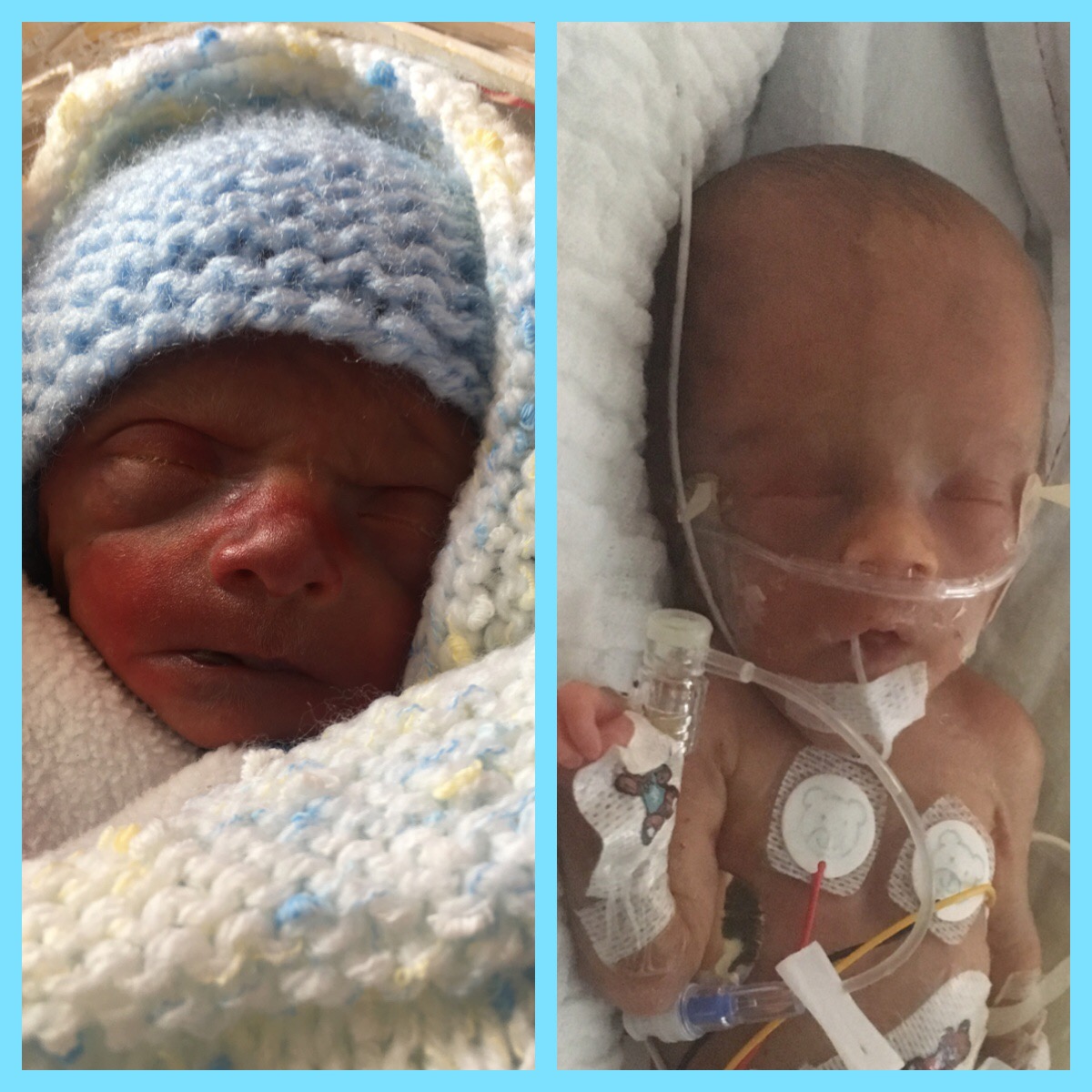 Leo And Tyler Identical Twins Born At 25 Weeks 3 Days Action Medical Research